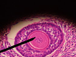 Human ovarian follicle.jpg