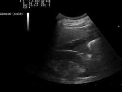 Ultrasound Scan ND 0110145312 1505060.png