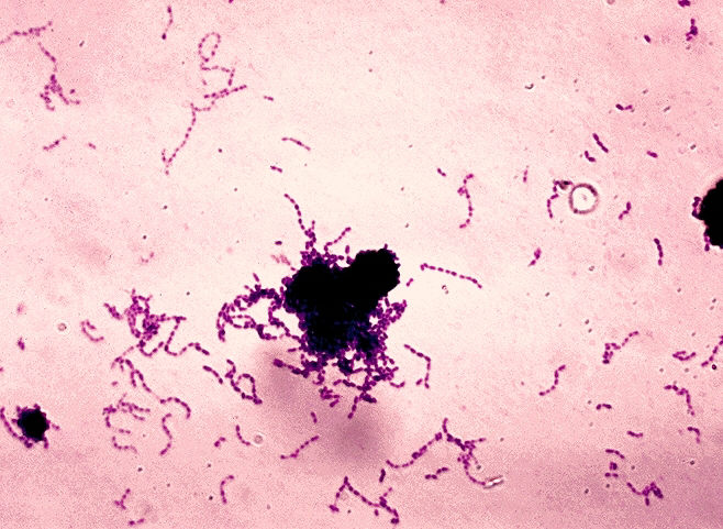 http://en.academic.ru/pictures/enwiki/83/Streptococcus_mutans_01.jpg