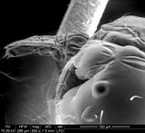 A head louse hatching from an egg (detail)