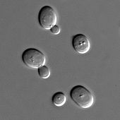 Microscopic view of five spherical structures; one of the spheres is considerably smaller than the rest and attached to one of the larger spheres