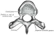 Drawing of a human vertebra