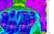  Thermal image of human body after 5 minutes of wearing CryothermicTM powered by ClimaCon® Technology